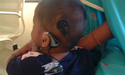 Performed 1st Cochlear implant in Thane dist.