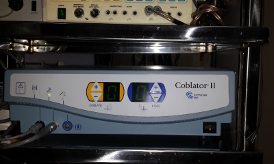 1st bloodless tonsillectomy and adenoidectomy in Thane dist was performed using plasma technology with Coblator.